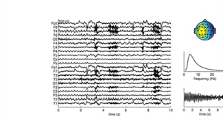 Tensor Decompositions  in Smart Patient Monitoring