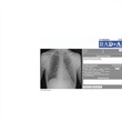 Data Science and Artificial Intelligence for Chest Radiology