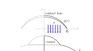 Mathematical Model Accounts for the Effect of Eye Deformation on Contact Lenses Comfort