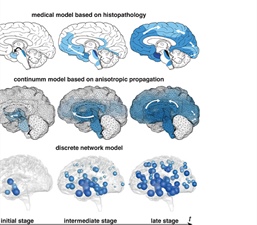 Multiscale Modeling of Dementia: From Proteins to Brain Dynamics