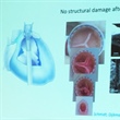 Computationally Modeling Tissue-Engineered Heart Valves