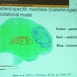 Image-Guided Neurosurgery: Computation of Brain Deformations