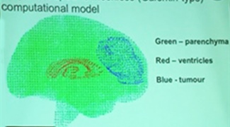 Image-Guided Neurosurgery: Computation of Brain Deformations