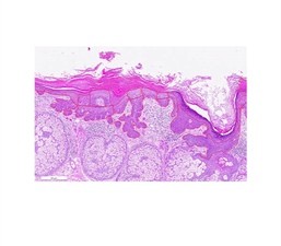 Deep Learning for Digital Pathology: Detecting Skin Diseases with Normalizing Flows